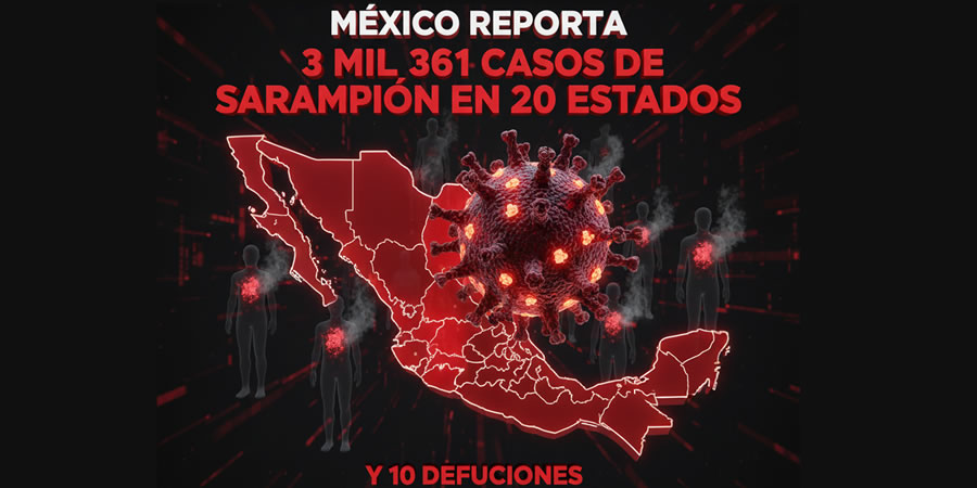 MÉXICO REPORTA 3 MIL 361 CASOS DE SARAMPIÓN EN 20 ESTADOS Y 10 DEFUNCIONES MÉXICO REPORTA 3 MIL 361 CASOS DE SARAMPIÓN EN 20 ESTADOS Y 10 DEFUNCIONES